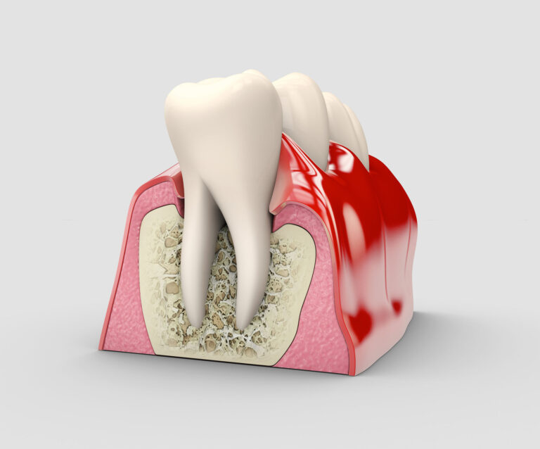 Lézeres kezelés a fogászatban – 5 hatékony tipp
